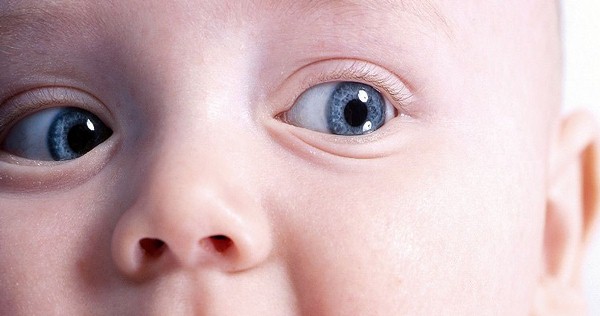 коньюктивит глаз лечение у детей